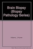 Brain biopsy : the smear technique for neurosurgical biopsies
