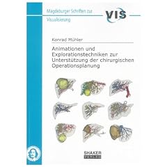 Animationen und Explorationstechniken zur Unterst�tzung der chirurgischen Operationsplanung