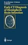 Early CT Diagnosis of Hemispheric Brain Infarction