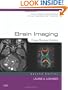 Brain Imaging: Case Review Series, 2e