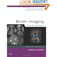 Brain Imaging: Case Review Series by Laurie A. Loevner MD