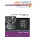 Brain Imaging: Case Review Series, 2e