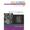 Brain Imaging: Case Review Series