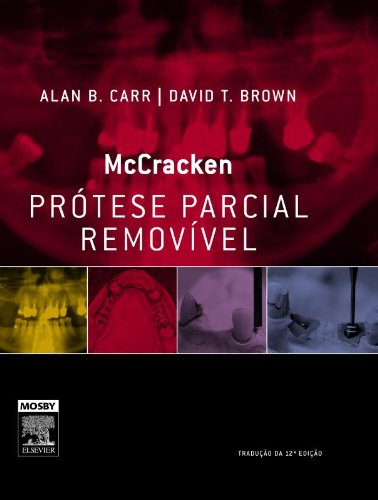 McCracken Prótese Parcial Removível (Em Portuguese do Brasil)