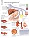 (22x28) Understanding Diabetes Educational Chart Poster