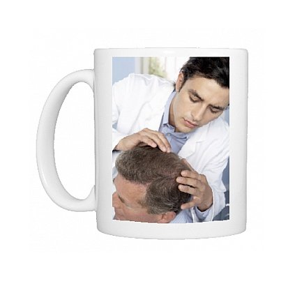 Photo Mugs of Hair transplant consultation from Science Photo Library