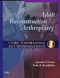 Core Knowledge in Orthopaedics: Adult Reconstruction and Arthroplasty