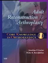 Core Knowledge in Orthopaedics: Adult Reconstruction and Arthroplasty
