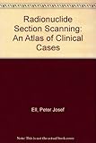 Radionuclide section scanning : an atlas of clinical practice