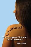 UnInked! The Complete Guide to Tattoo Removal
