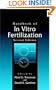 Handbook of In Vitro Fertilization