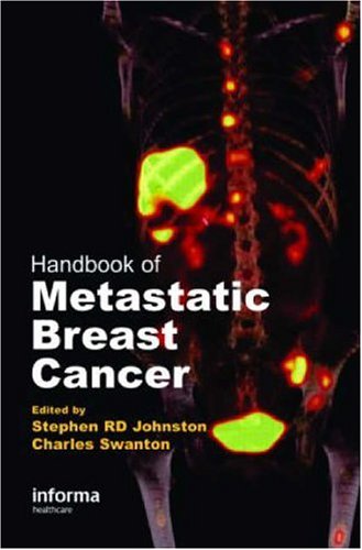 Handbook Metastatic Breast Cancer