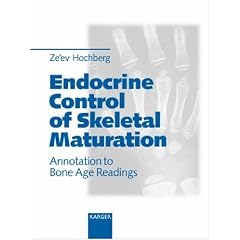 Endocrine Control of Skeletal Maturation: Annotation to Bone Age Readings
