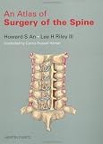 Atlas of Surgery of the Spine