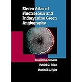 stereo atlas of fluorescein and indocyanine green angiography 1e