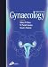 Books : Gynaecology