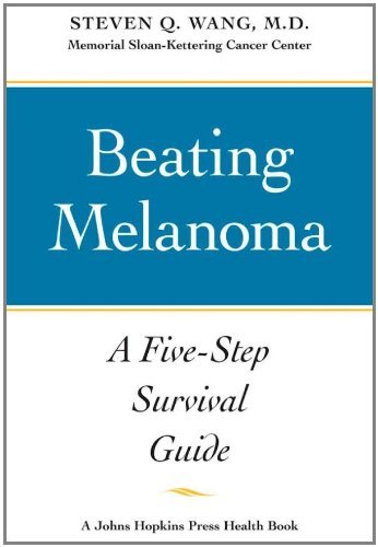 melanoma