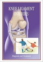 Knee Ligament Injuries