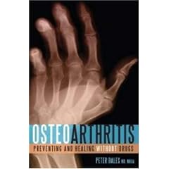 Osteoarthritis: Preventing and Healing Without Drugs