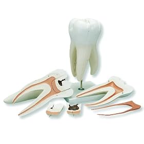 3B Scientific D15 6 Part Giant Molar with Dental Cavities Model, 15 Times Life Size, 9.4" x 4.7" x 5.1"