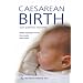 Caesarean Birth: Your Questions Answered