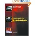 Imaging of the Scrotum and Penis by Matthew Rifkin and Dennis L. Cochlin