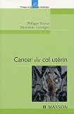 Cancer du col ut�rin