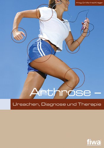 Arthrose: Ursachen, Diagnose und Therapie (German Edition)