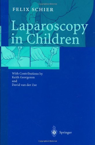Laparoscopy in Children