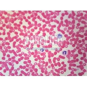 Human Blood Microscope Slide, smear