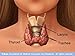 Overcoming from the Problem Of Thyroid! Overcoming from the Problem Of Thyroid!