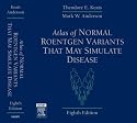 Atlas of Normal Roentgen Variants That May Simulate Disease