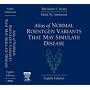 Atlas of Normal Roentgen Variants That May Simulate Disease