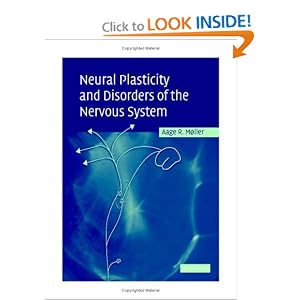 41T41FQVK8L. BO2,204,203,200 PIsitb sticker arrow click,TopRight,35, 76 AA300 SH20 OU01  Neural Plasticity and Disorders of the Nervous System