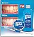 Celebrity White Tooth Whitening System