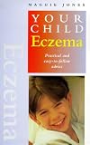 Eczema: Practical and Easy-to-follow Advice (Your Child)