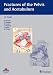 Search : Fractures of the Pelvis and Acetabulum