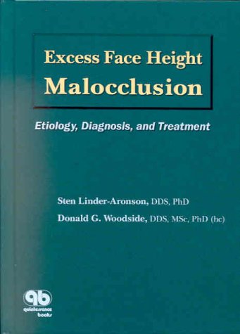 Excess Face Height Malocclusion: Etiology, Diagnosis, and Treatment