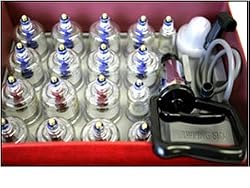 Cupping Therapy 2-in-1 Acupuncture Magnetic Therapy