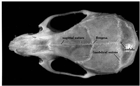 The Mouse Brain in Stereotaxic Coordinates (Deluxe Edition)