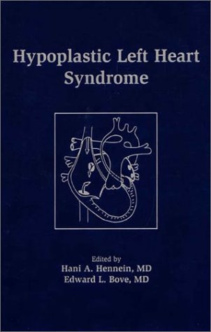Congenital-Heart-Disease