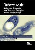 Tuberculosis : laboratory diagnosis and treatment strategies
