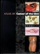 Atlas of Cancer of the Skin (Sams/Lynch colour atlas)