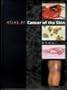 Atlas of Cancer of the Skin, 1e (Sams/Lynch Colour Atlas)