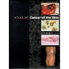 Atlas of Cancer of the Skin (Sams/Lynch colour atlas)