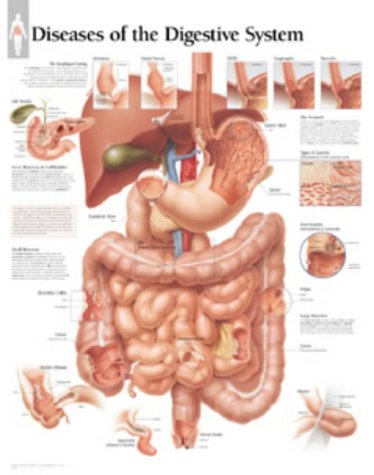Digestive-Diseases