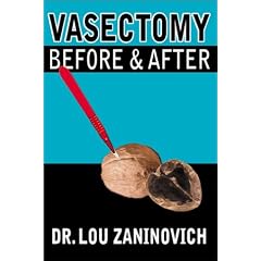 Vasectomy - Before and After