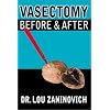 Vasectomy - Before and After