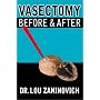 Vasectomy - Before and After