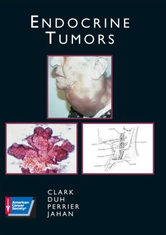Endocrine-Diseases